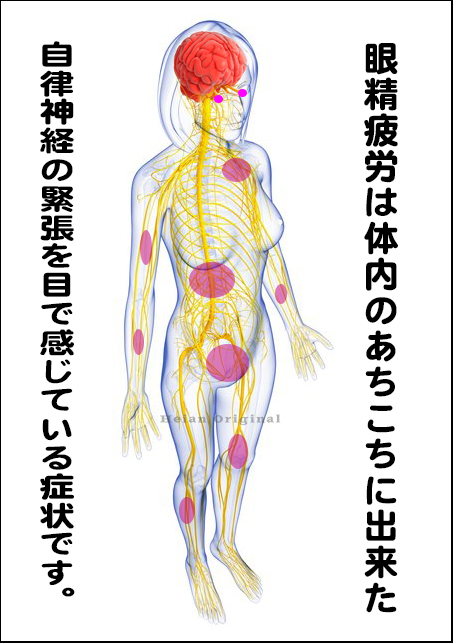 眼精疲労 目の痛みは大いに改善します 眼精疲労専門外来 平安コンディショニング 大阪 京都 神戸 名古屋から来訪