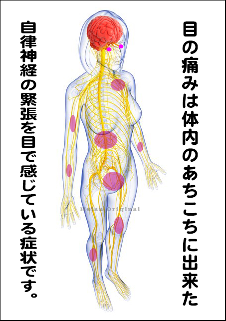 目の痛み